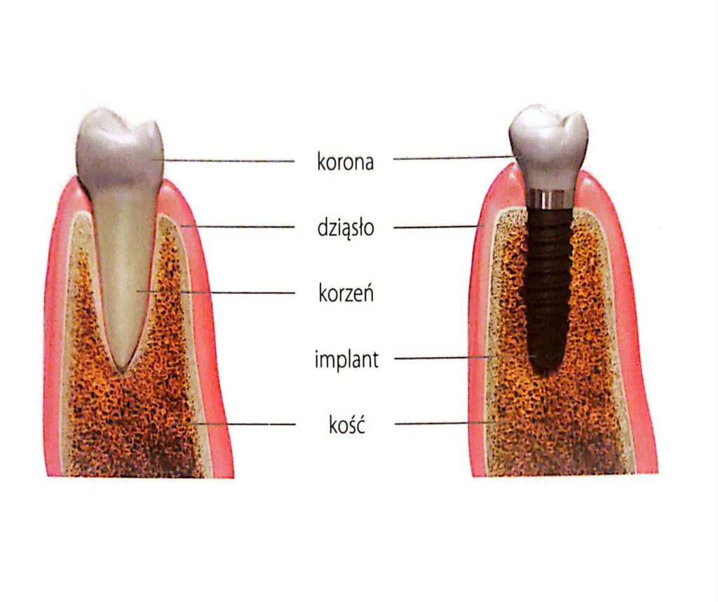 MI-DENT Gabinet stomatologiczny Zgierz z mi-dent.eu