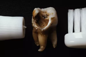 Mi-Dent Gabinet Stomatologiczny 95-100 Zgierz ul.Kolejowa 6 lokal 1A